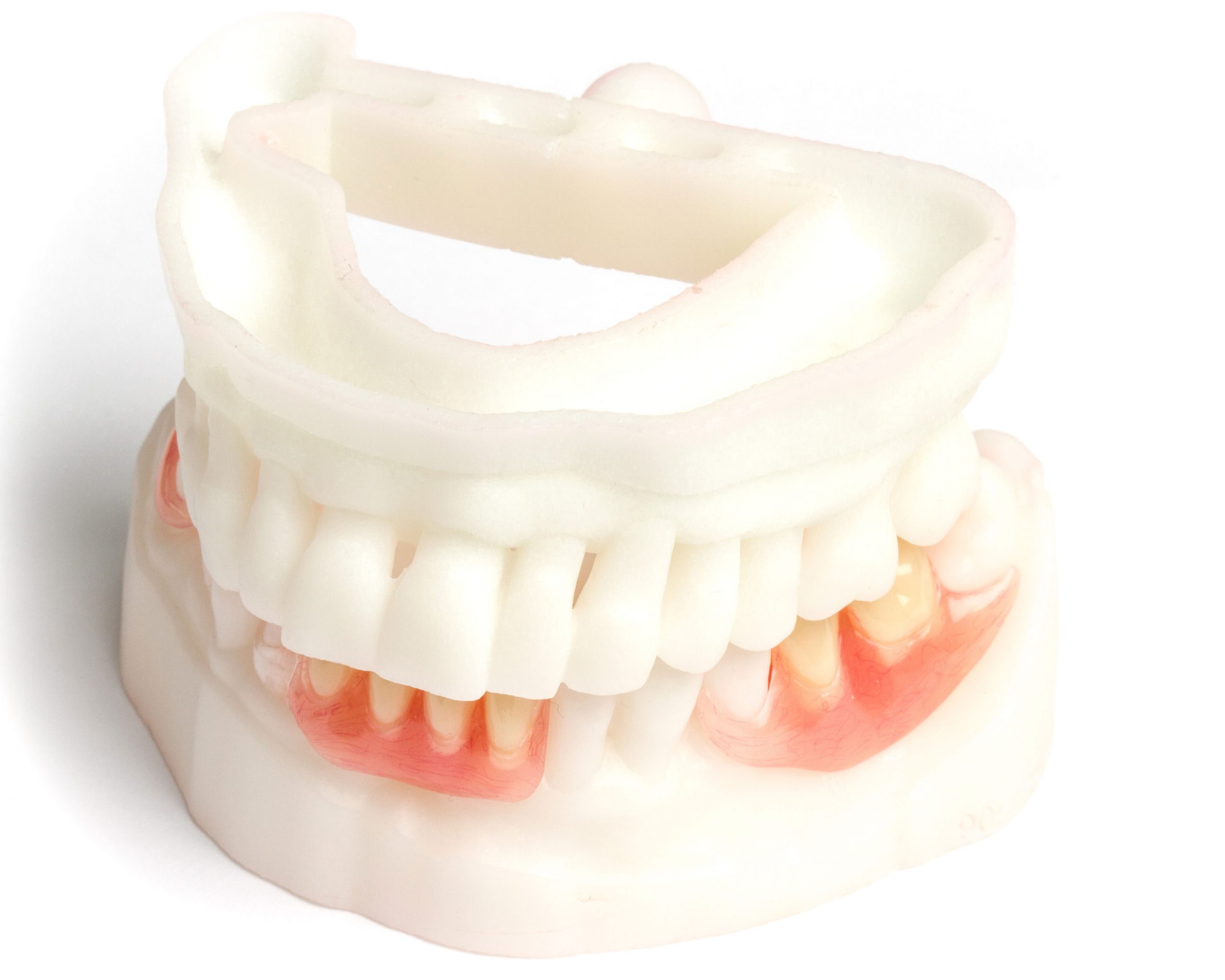 partial denture and 3d printed models