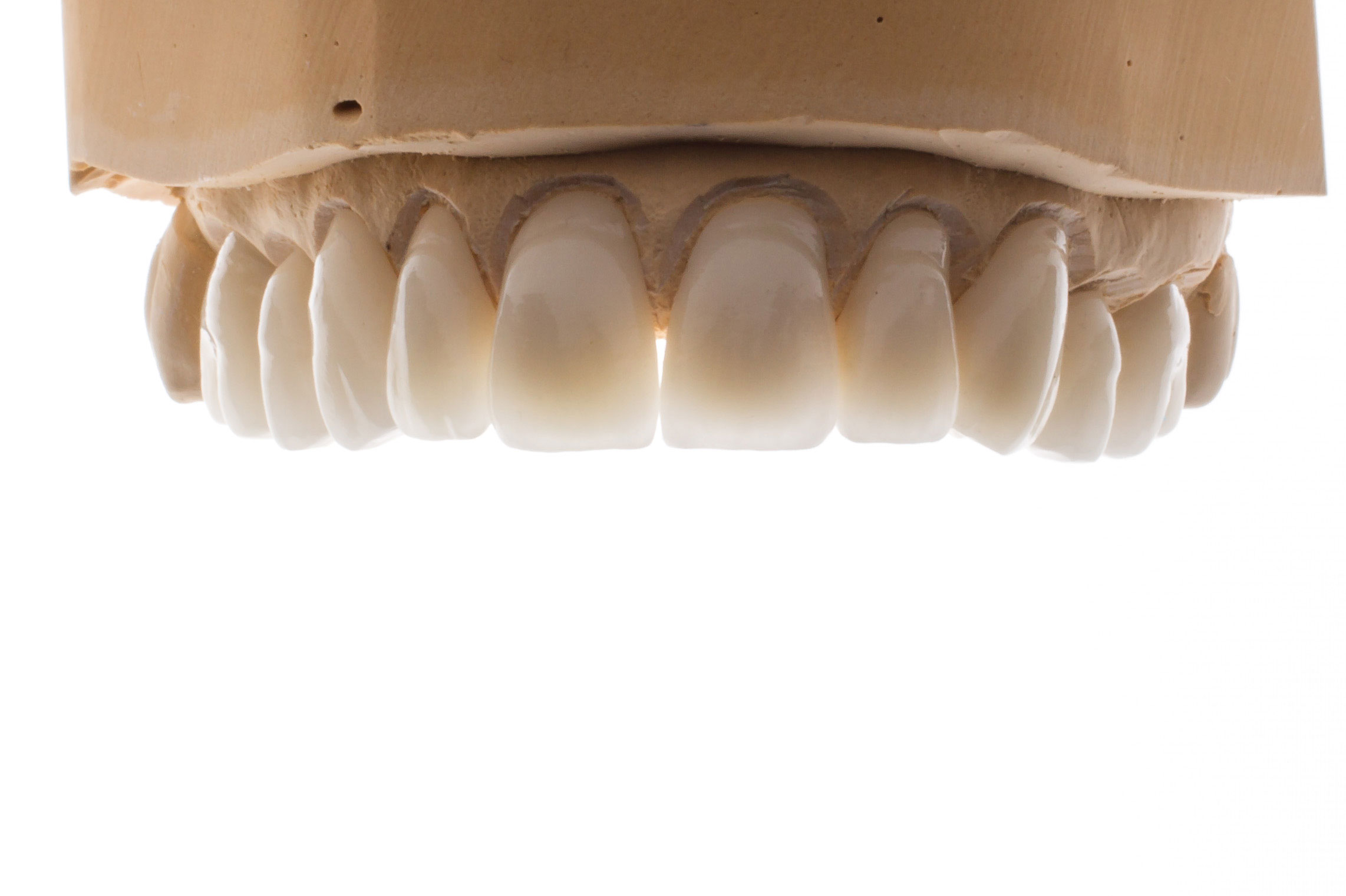 zirconia crown
