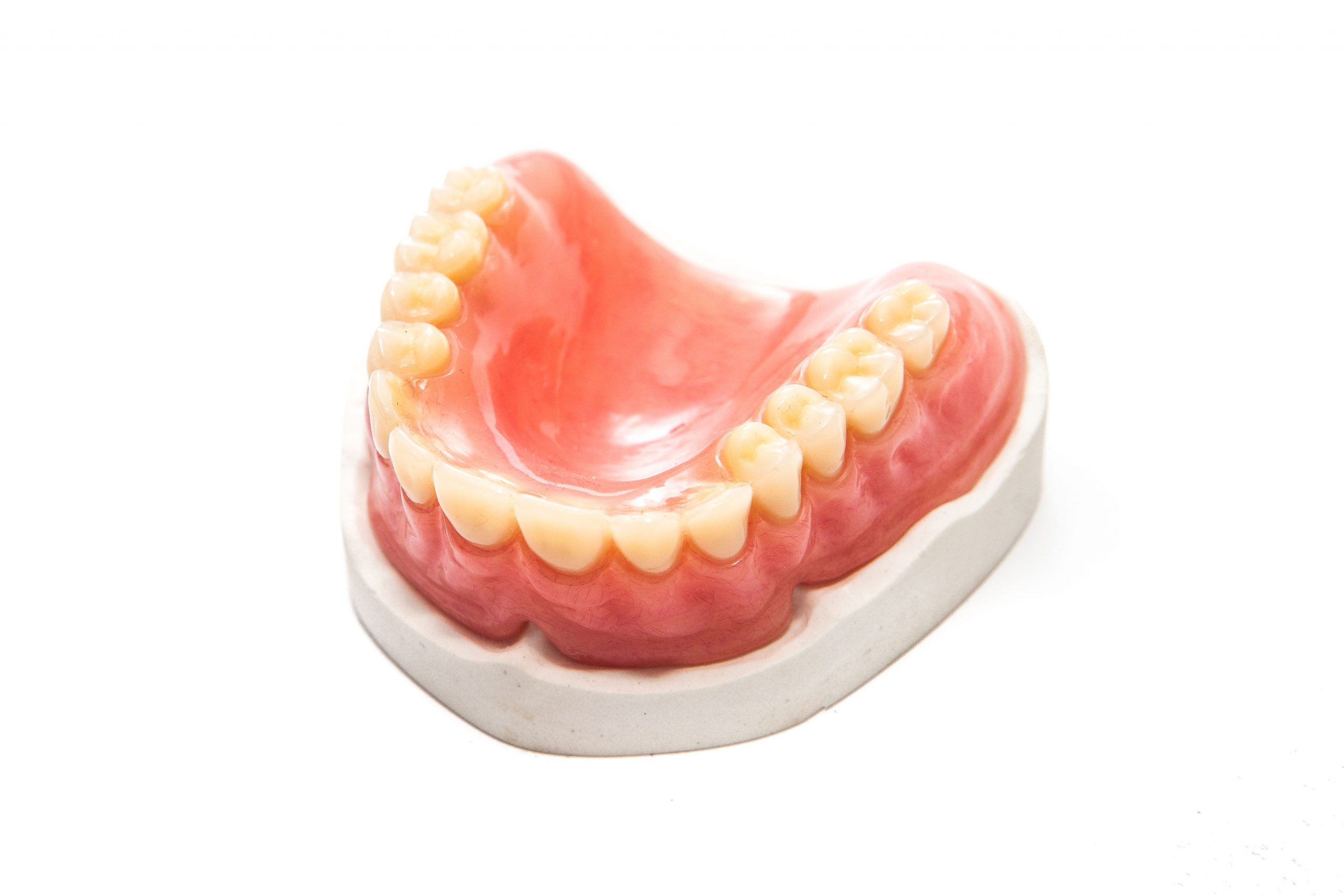 dental impressions and models at dental lab