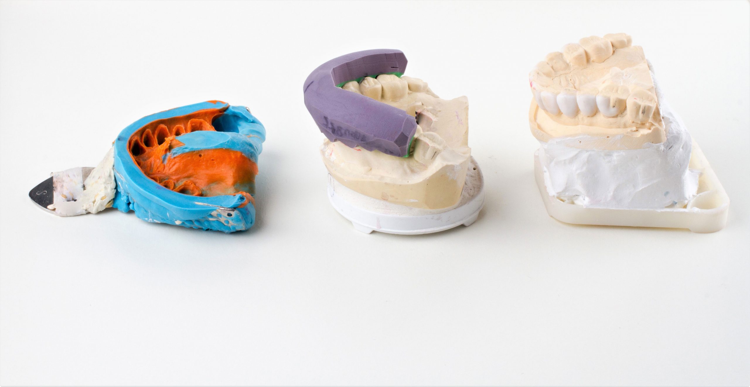 dental impressions and models at dental lab