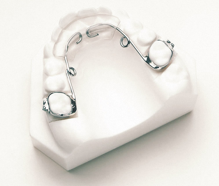 dental impressions and models at dental lab