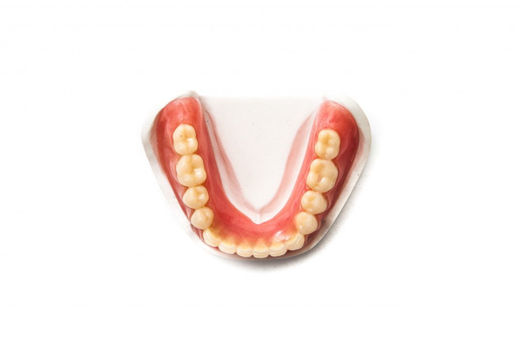 occlusal view denture