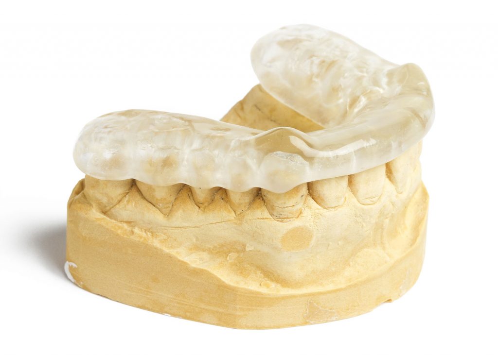 full upper denture 3
